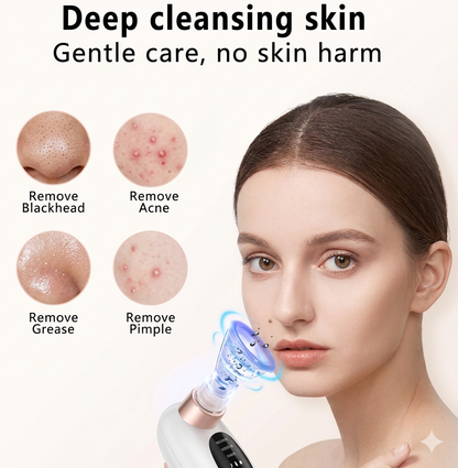 USB Rechargeable Blackhead, Pimple, Acne Remover Pore Vacuum