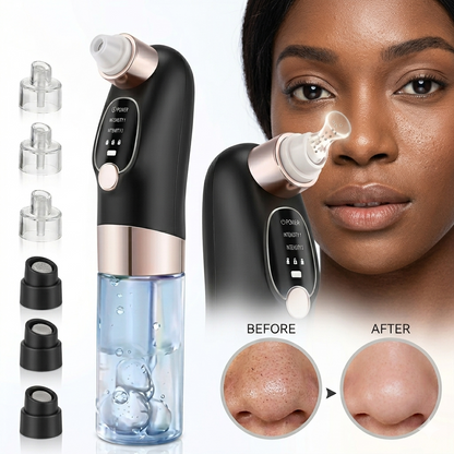 USB Rechargeable Blackhead, Pimple, Acne Remover Pore Vacuum
