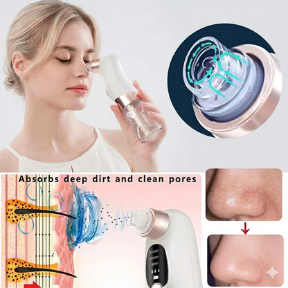 USB Rechargeable Blackhead, Pimple, Acne Remover Pore Vacuum