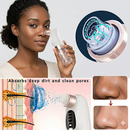 USB Rechargeable Blackhead, Pimple, Acne Remover Pore Vacuum